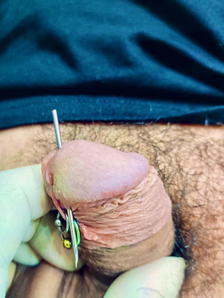 穿PA環了～
🐔💍1.6mm
—————————————————
D1 
剛穿完會滲血，尿尿會刺痛還會亂噴⋯