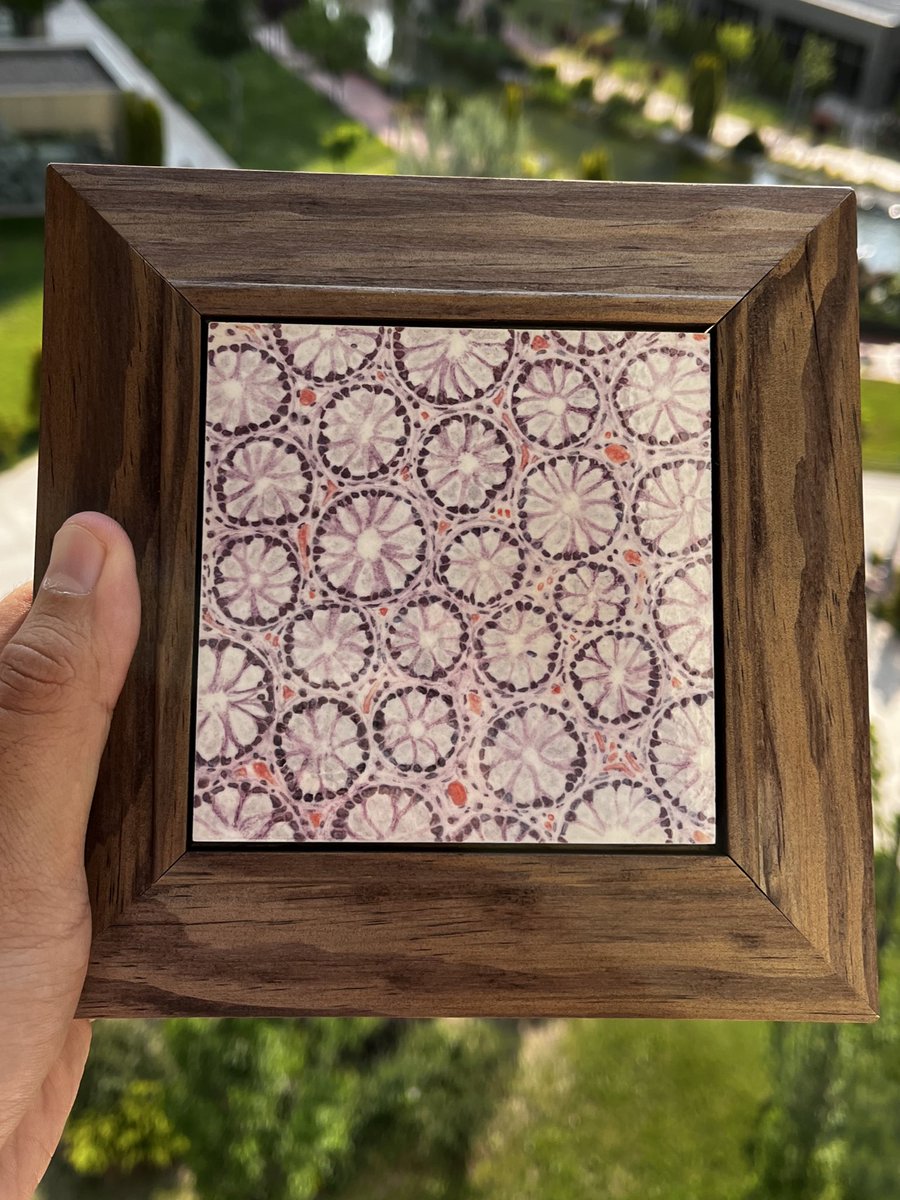 The first pathology tile in the world-colonic crypts aka "field of flowers" fresh out of the kiln!
This piece marks my very first pathology inspired tile.
A tribute to science and my heritage. 🔬🎨 #Pathology #histology #medicalart #pathologyart #çini #art