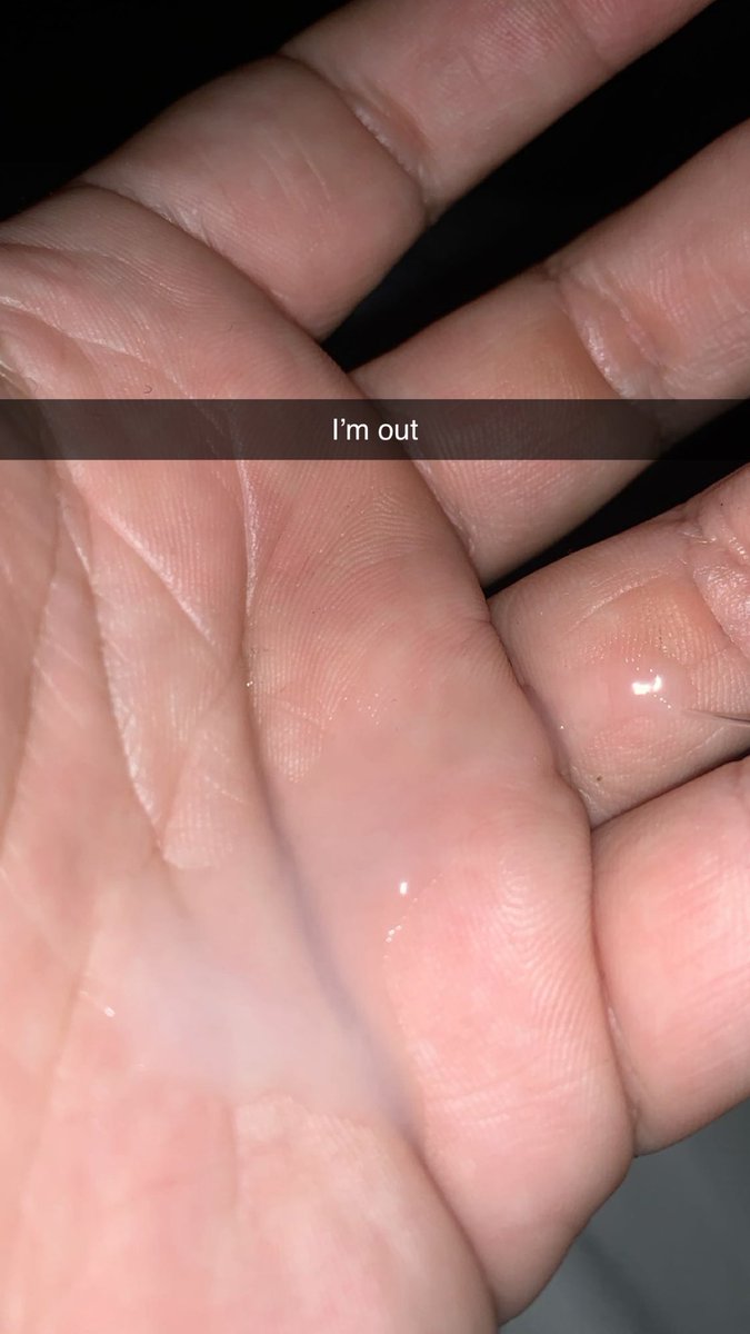 estewally tweet media