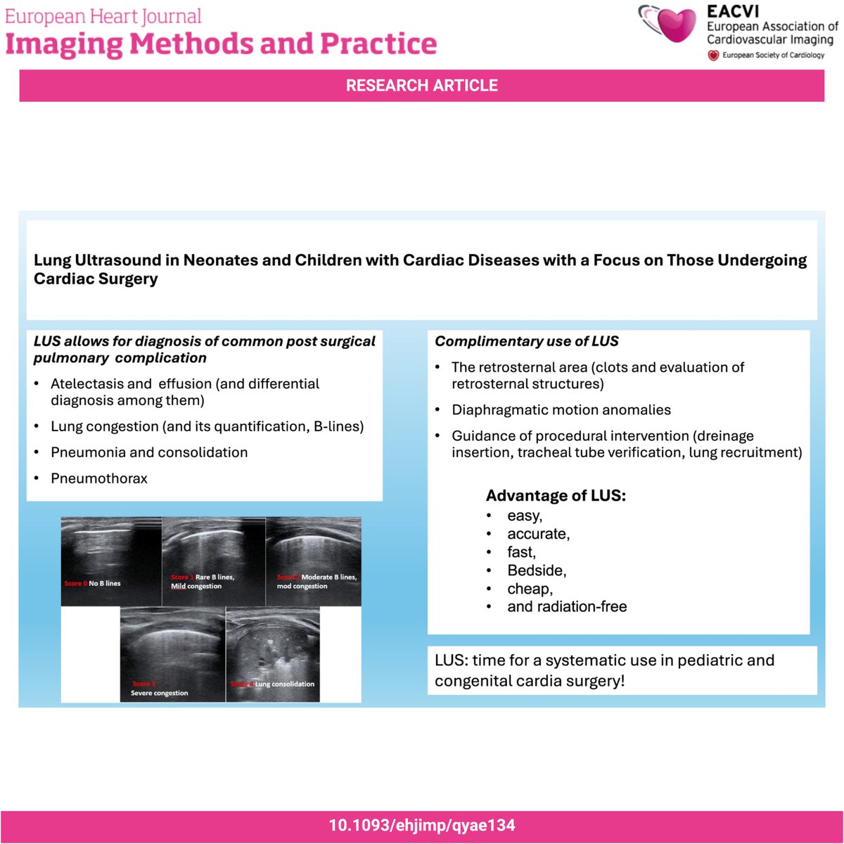 EHJ-IMP Editor-in-Chief (@ehjimpeic) on Twitter photo #EHJIMP 🧒🫁 Can we use lung ultrasound in pediatric cardiology? 🖋️ This expert opinion from the <a href="/AEPCcongenital/">AEPC - Paediatric and Congenital Cardiology</a> Imaging WG outlines key principles, diagnostic applications, limitations, and future directions 🔍 Read more 👉 doi.org/10.1093/ehjimp… #EHJIMP 🧒🫁 Can we use lung ultrasound in pediatric cardiology? 🖋️ This expert opinion from the <a href="/AEPCcongenital/">AEPC - Paediatric and Congenital Cardiology</a> Imaging WG outlines key principles, diagnostic applications, limitations, and future directions 🔍 Read more 👉 doi.org/10.1093/ehjimp…
