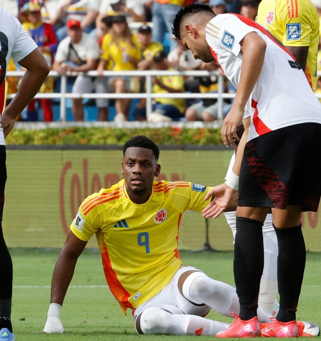 Duran se acabó la carrera en tiempo record y ahora armo un cabaret en la selección. 

Se lo comió el personaje a este imbécil, ojalá no lo convoquen nunca más.