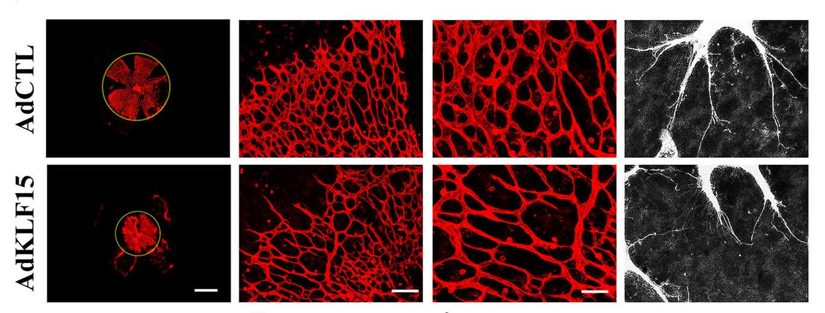 Zhang &amp; colleagues found a new mechanism where the #KLF15/VASN axis controls #Notch1 signaling to regulate #ngiogenesis. Learn more at ahajrnls.org/445hz92