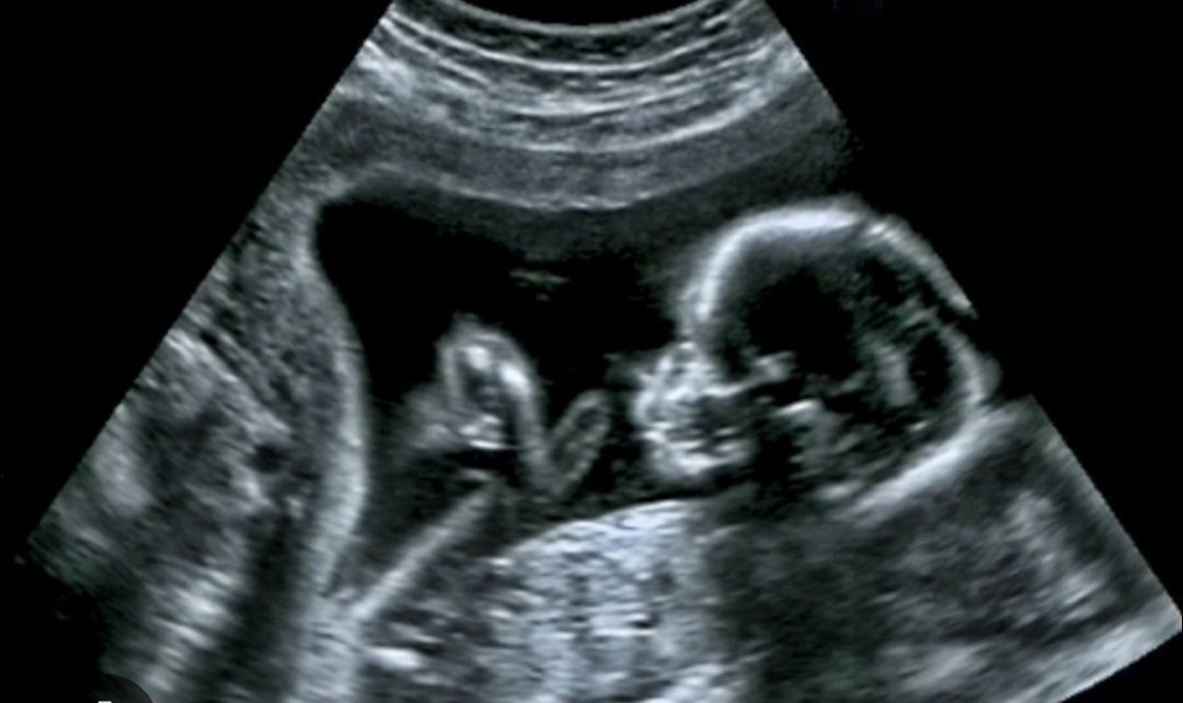 SamiiLFC's tweet image. Felt cute might delete XD