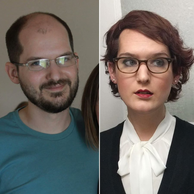 VertigoWarrior's tweet photo. The Most Extreme Before/After Photos You'll See Today 🧵

1. Yes, it is the same person https://t.co/ya5dTM2x3m