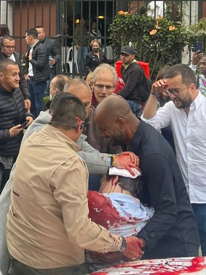 Al parecer Miguel Uribe Turbay, habria fallecido.... duele nuestra patria.. duele como un putas