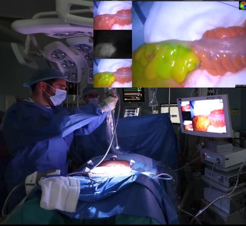 SurgeryUhw's tweet photo. Congratulations Dr Philip McEntee on winning best non-plenary oral presentation at the The 5th Annual @UHW_Waterford VideoSurgery Meeting @Matersurgery 👏👏👏👏👏 https://t.co/9aHChgcPj2