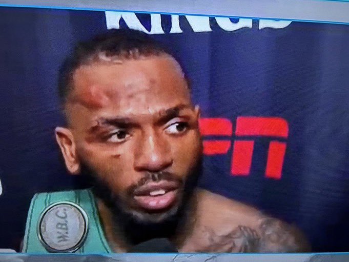 Keyshawn Davis and Keon jumped Nahir Albright in the locker room after he beat their brother and they gave him a knot on his head ? Keyshawn going out sad dawg‼️