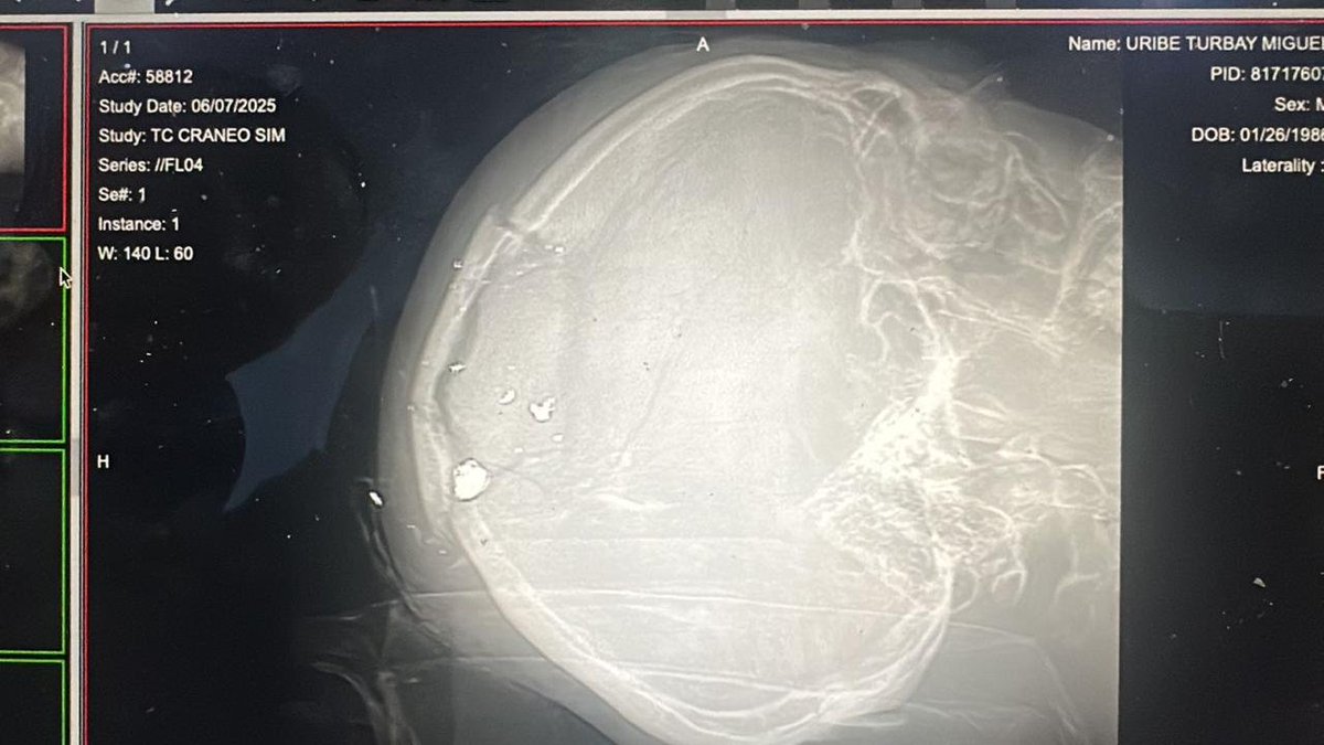 Cómo dueles Colombia 🇨🇴