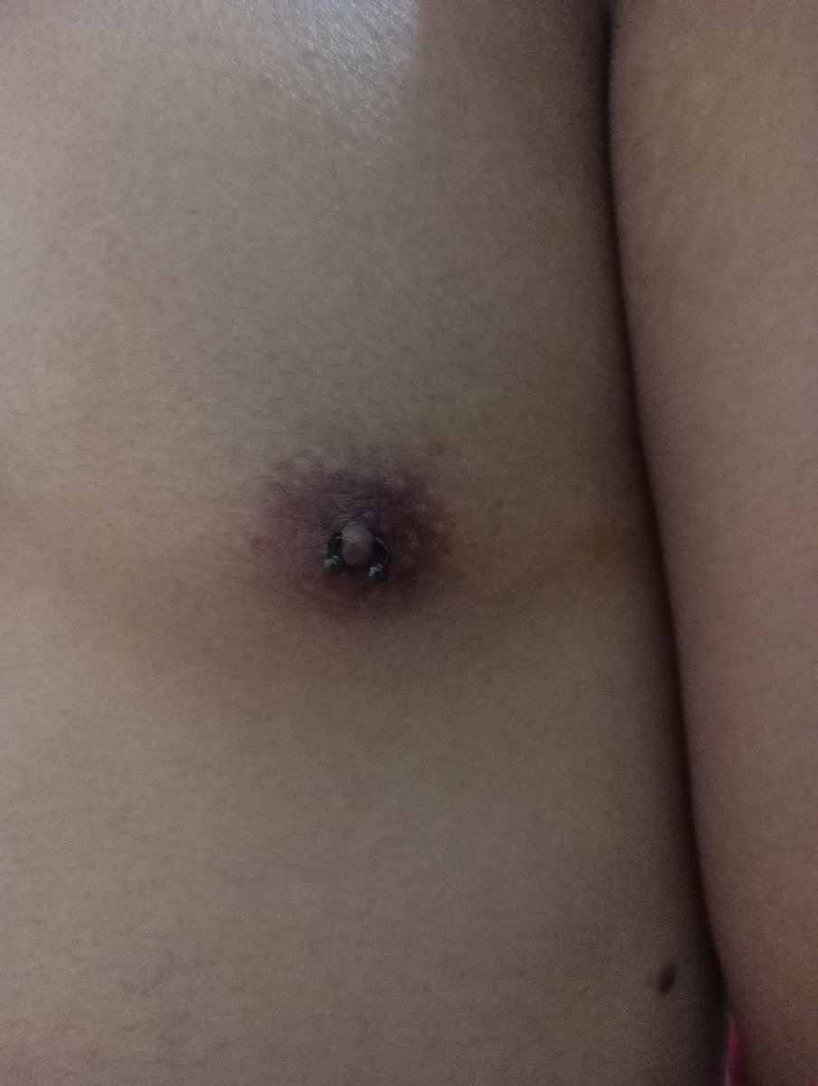 MasterRyan1611's tweet photo. #Pierching
#Bdsm https://t.co/oLrRAsEQgP