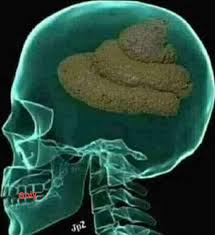 AngelaF61638605's tweet photo. @OlgaBazova her brain RX https://t.co/LaO8ZPBXOc