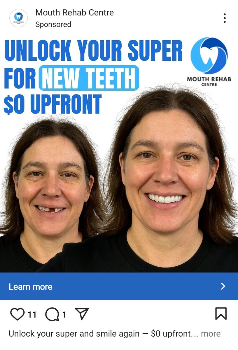 Logged in to instagram for the first time in a while. 

On the plus side, fewer hairloss treatment ads.

On the downside, the ad algo now thinks I'm a broke meth head.

Straya