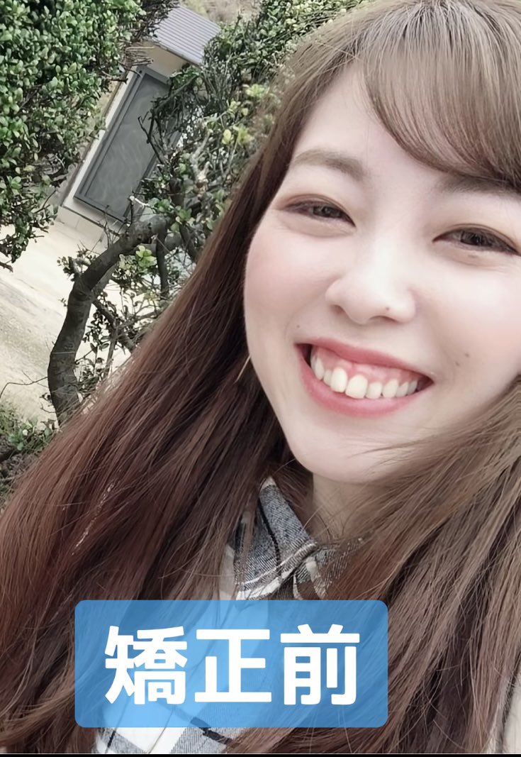 teethfe's tweet photo. 矯正頑張ったらキラキラ光る銀歯まで手にしたんだね https://t.co/3DxyAzJ5H2