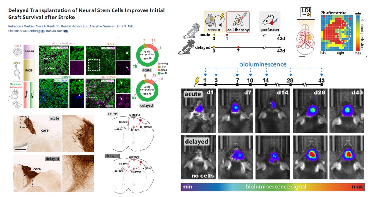 HaoYin20's tweet image. Delayed Transplantation (7 vs 1 dpi) of #NeuralStemCell Improves Initial Graft Survival after #Stroke

In vivo lineage fate favors neuron over astrocyte

⏫graft axon extension along #CorpusCallosum to contralateral hemisphere 

@RebeccaZ_Weber @CTackenberg @rust_ruslan #AdvSci…