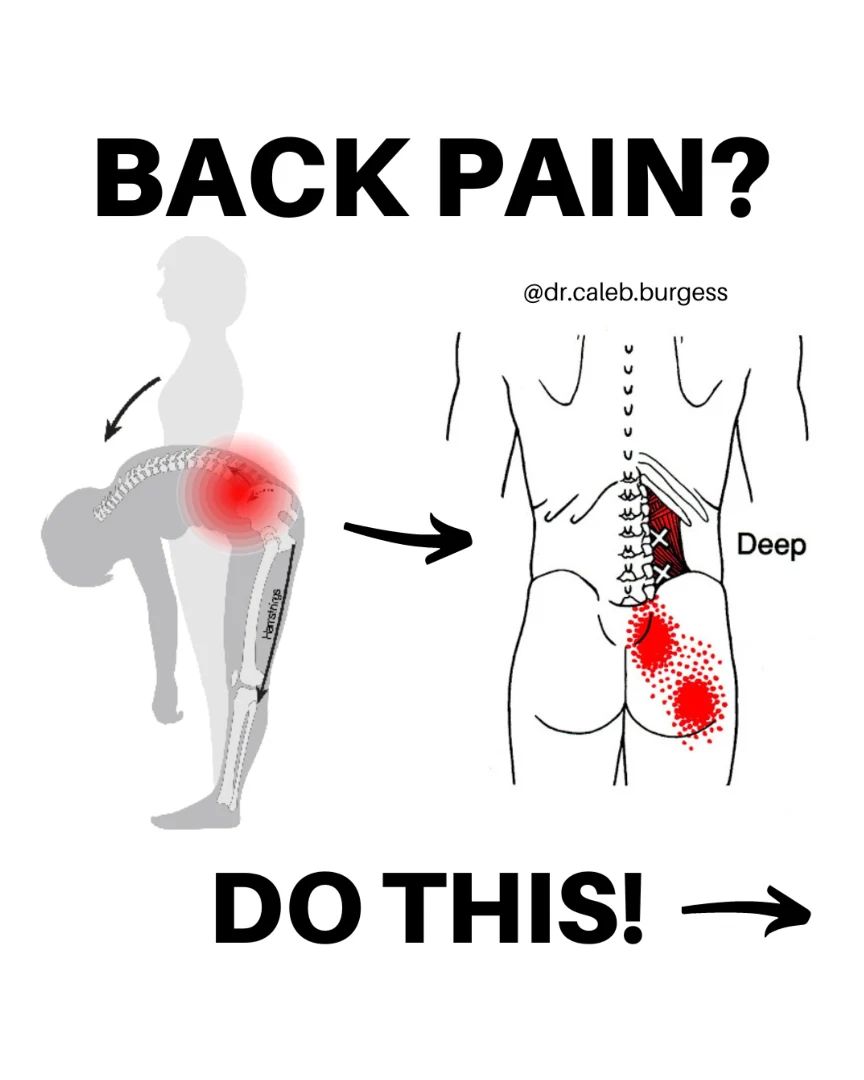 Back pain?..................... Do This