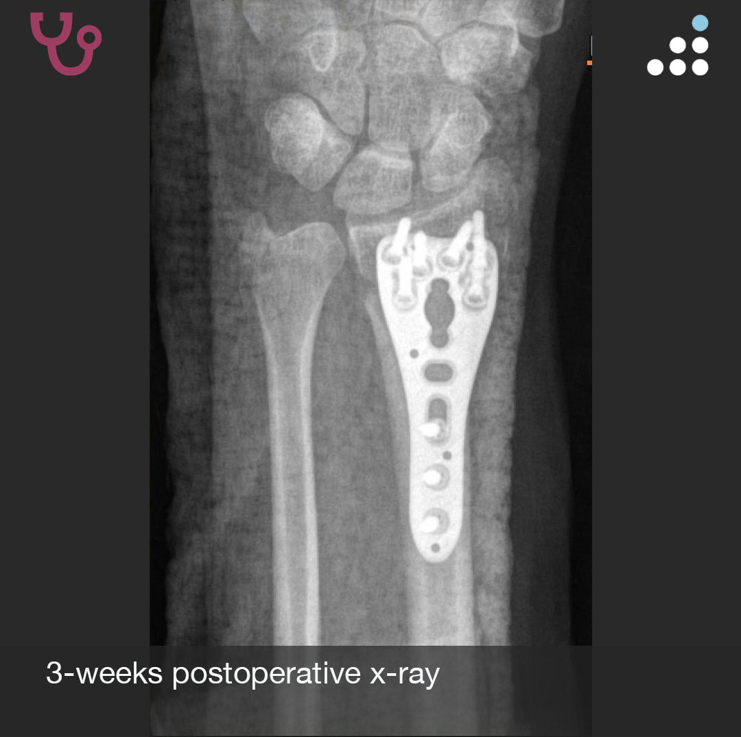 Orthobullets tweet media