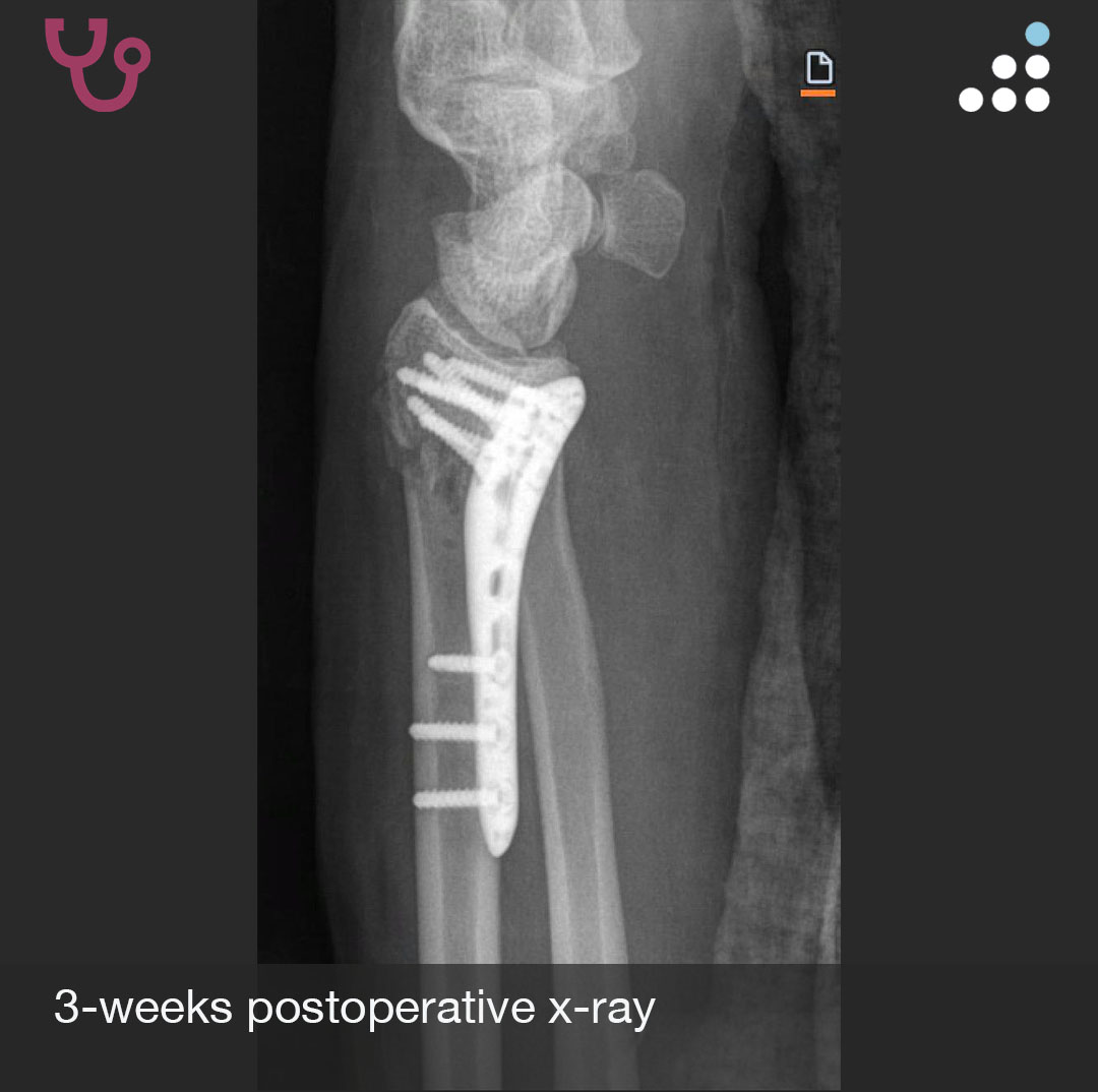 Orthobullets tweet media