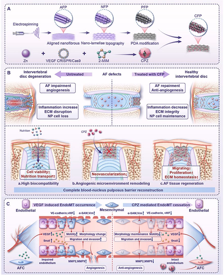 Biomaterials_'s tweet image. NanoCRISPR-Assisted Biomimetic Tissue-Equivalent Patch Regenerates the Intervertebral Disc by Inhibiting Endothelial-to-Mesenchymal Transition doi.org/10.1016/j.biom…