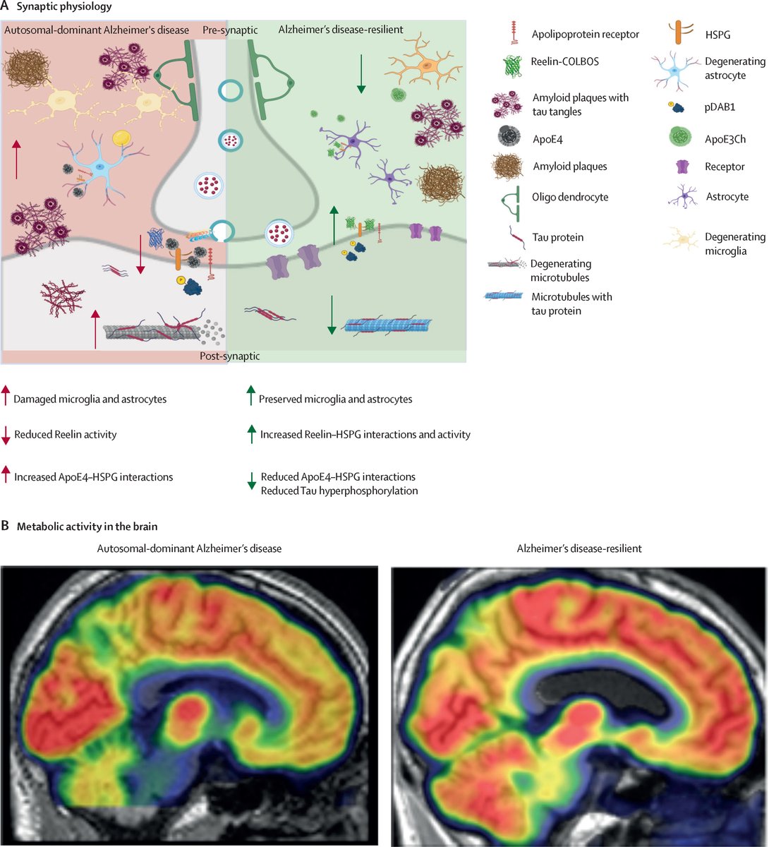The Lancet (@thelancet) on Twitter photo Protective genetic variants may help prevent Alzheimer's disease development in those who carry them.
A Review in <a href="/TheLancetNeuro/">The Lancet Neurology</a> explores the latest evidence on genetic variants and their potential to slow down or stop Alzheimer's disease: hubs.li/Q03r2mHN0 Protective genetic variants may help prevent Alzheimer's disease development in those who carry them.
A Review in <a href="/TheLancetNeuro/">The Lancet Neurology</a> explores the latest evidence on genetic variants and their potential to slow down or stop Alzheimer's disease: hubs.li/Q03r2mHN0