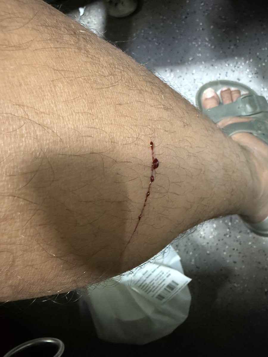 deepak1682's tweet photo. @IRCTCofficial @AshwiniVaishnaw i just hurt myself because of the sharp rusted edges on the berth. Can you help me 
Train no 12739
Pnr 6553785462 https://t.co/XONV8zqAMT
