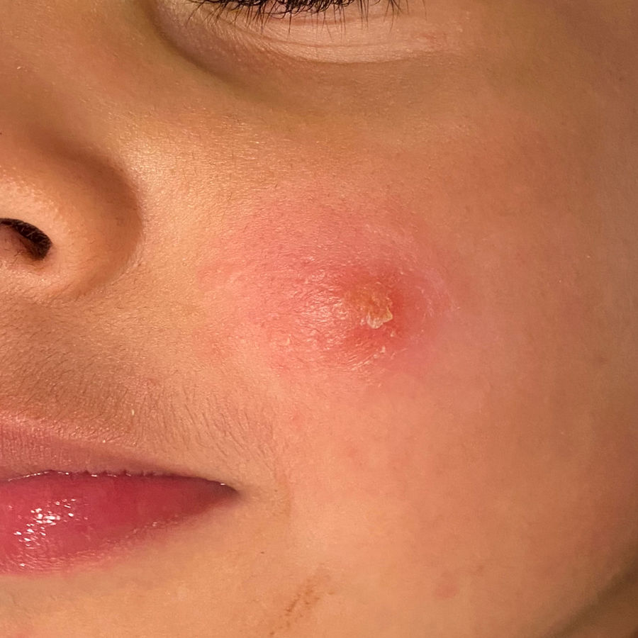 Noticaribe tweet media