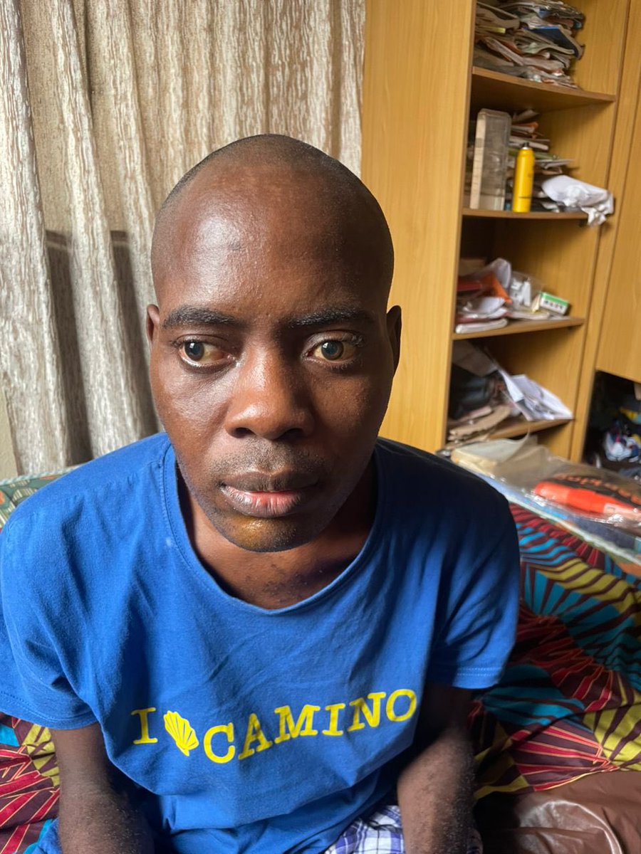 lollypeezle's tweet photo. 🚨🚨
Please take this Sunday to RT and come to the aid of Olawale Ayoola who is suffering from Brain Tumor.

He has undergone surgeries at UCH that have rendered him blind. He has now secured a visa to travel out for treatment at a cost of 30 million Naira. 6.5m has been raised🙏 https://t.co/GUrmRxyYu6