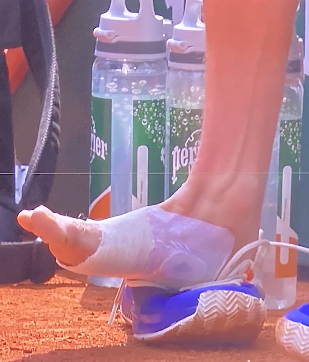 That’s how he had to play. But did he ever complain? NEVER!
Greatest champion!!! That win was yours. Whatever idiots say. 🦊👑🎾🏆🥇👏🏼👏🏼👏🏼👏🏼👏🏼👏🏼👏🏼🫶🏼🫶🏼🫶🏼🫶🏼🫶🏼🫶🏼🫶🏼