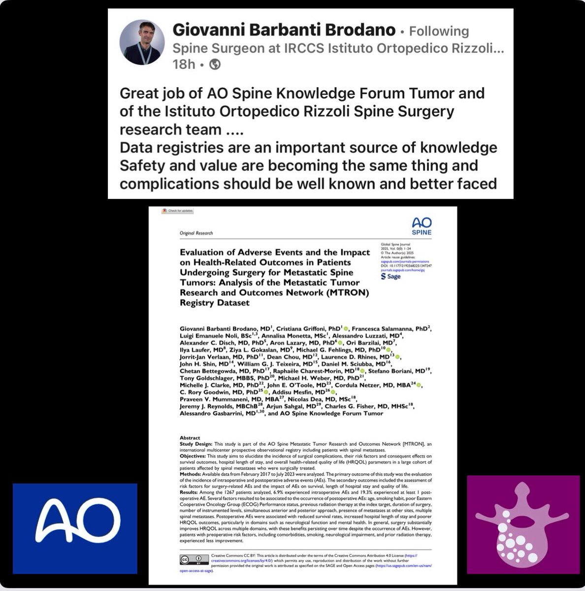 MGalganoMD's tweet image. Latest collaborative efforts from the @AOSpine Tumor Knowledge Forum!
Link to manuscript ⬇️⬇️⬇️
journals.sagepub.com/doi/10.1177/21…