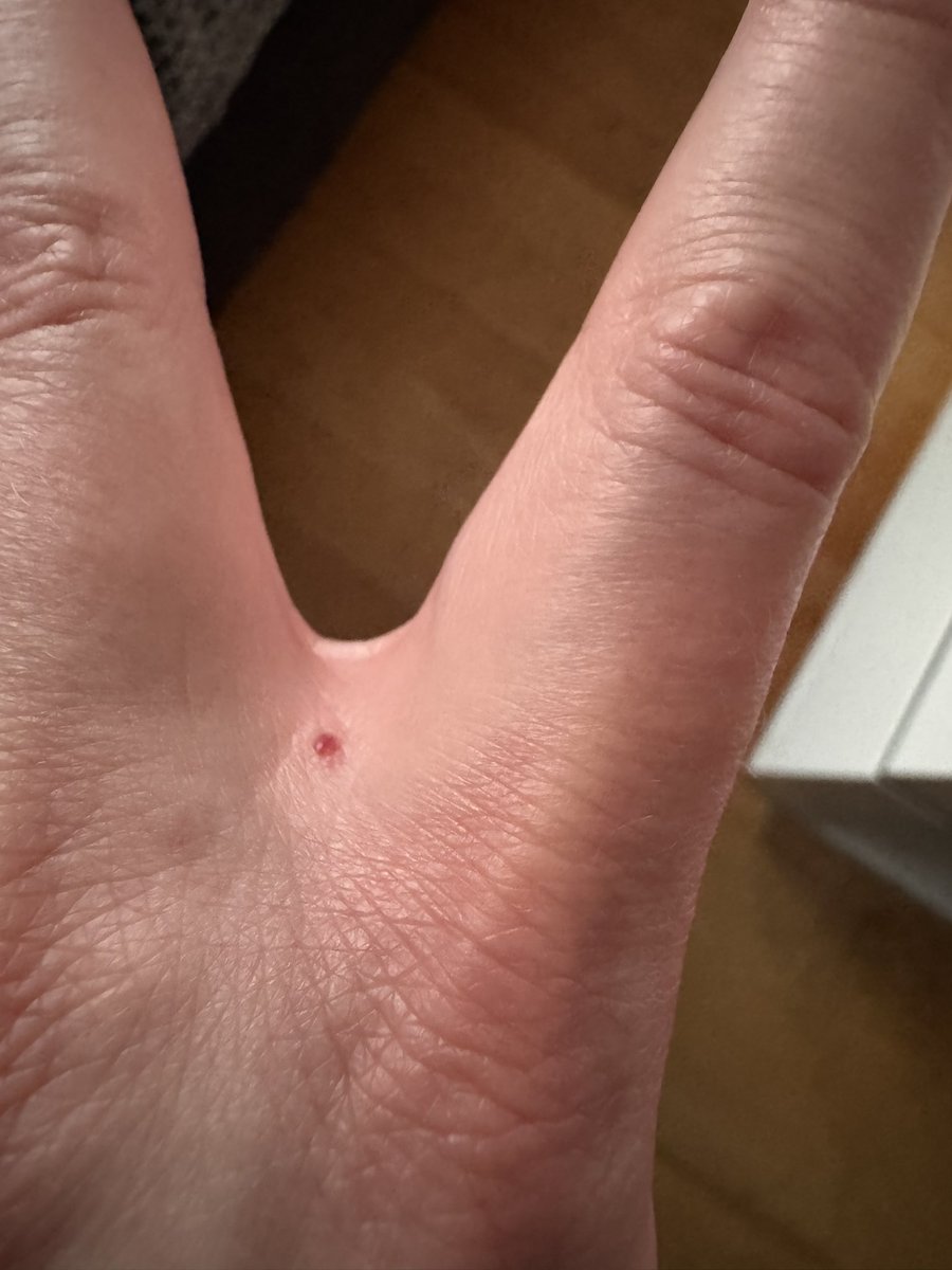 Nee wie fies. Da hat mich doch glatt an dieser Stelle ne Mücke gepiesackt. Und es juckt auch noch wie sonst was 🙈