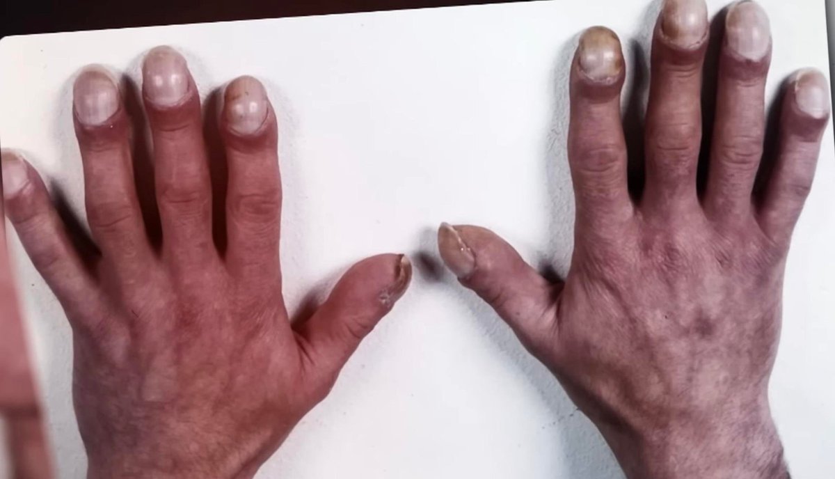 Imagine the fingerfսcking power these bad boys have