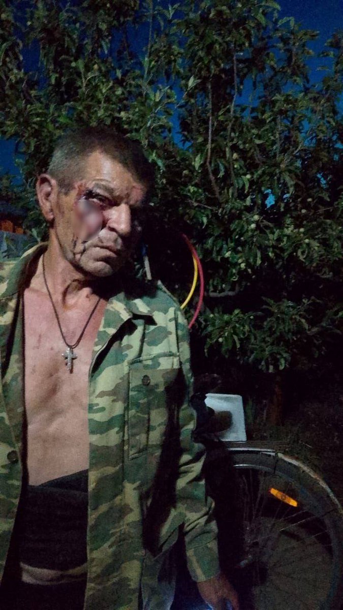 Anton4890914259's tweet image. Дети оборигенов жестоко избили пенсионера в Ростовской области из-за замечания. Потом к избиению подключились и взрослые оборигены, в итоге старика чуть не убили. 

Инцидент произошел 7 июня в 19:30 в хуторе Денисов.