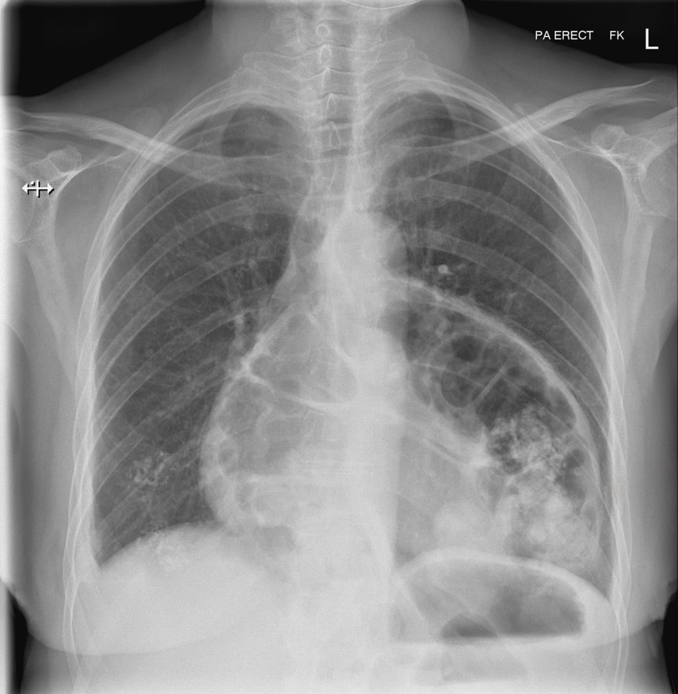 ENARM_intensivo's tweet image. ¿Qué es esto?