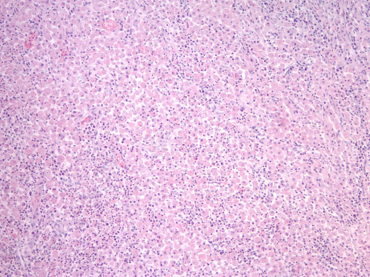 Jake Bledsoe tweet media