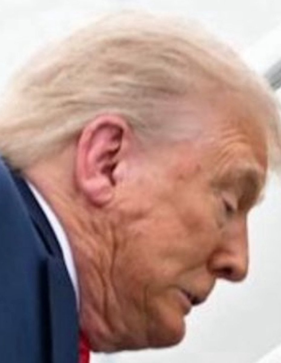 Did Trump’s ear get hit by AR-15 bullet?