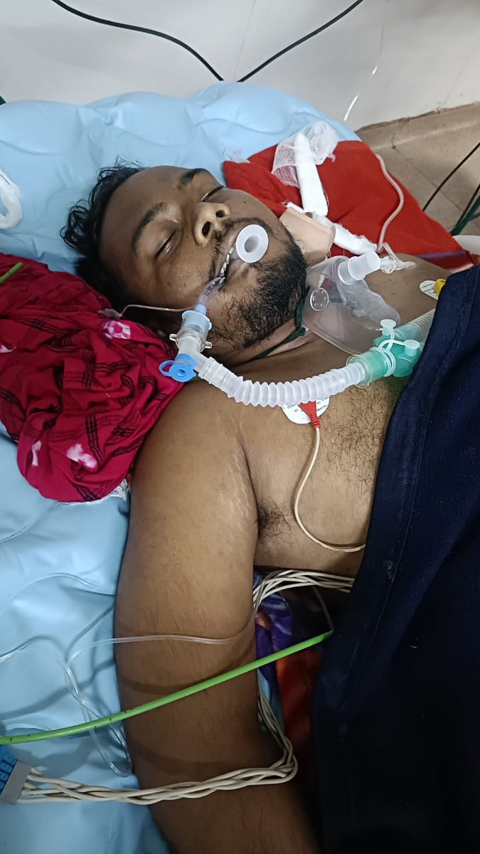 <a href="/brijmohan_ag/">Brijmohan Agrawal</a> <a href="/CGVOICE00777/">Voice of Chhattisgarh</a> <a href="/ChhattisgarhCMO/">CMO Chhattisgarh</a> <a href="/CspdclOfficial/">CSPDCL</a> <a href="/ShrivasGouri/">Gouri Shanker Shrivas</a> अभी भी सबूत की जरुरत है क्या की विद्युत् संविदाकर्मचारी अन्य विभाग के कर्मचारी से अलग प्रवृति के कार्य करते हैंअगर मानवीय संवेदनाबचा हैतो आवाज जरूर उठाऐ।2016-25तक 25से अधिक लोग की दुर्घटना हुआ और क्याचहिए