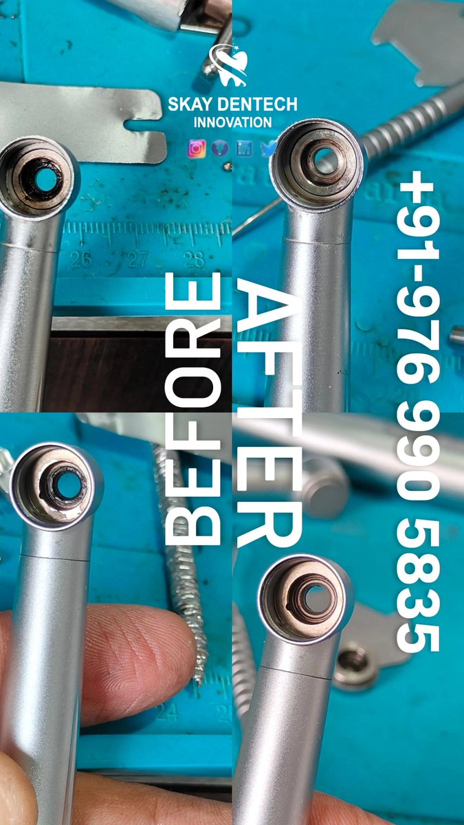 Skay Dentech Innovations (@handpieceexprt) on Twitter photo #dentalhealth #dentalclinic #dentalcare #dentalequipment #dentalhandpiece #dentalservice #repairshop #endodontics #endodontist #dentist #dentistry #Dentist #dentalimplants #dentalhygiene #SkayDentech <a href="/soham1087/">SOHHAM KHATRII</a> #dentalhealth #dentalclinic #dentalcare #dentalequipment #dentalhandpiece #dentalservice #repairshop #endodontics #endodontist #dentist #dentistry #Dentist #dentalimplants #dentalhygiene #SkayDentech <a href="/soham1087/">SOHHAM KHATRII</a>