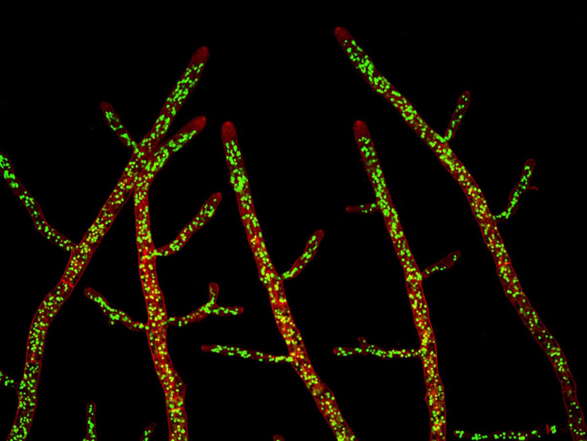 jmarieali's tweet image. #micro #fungi #hyphae
