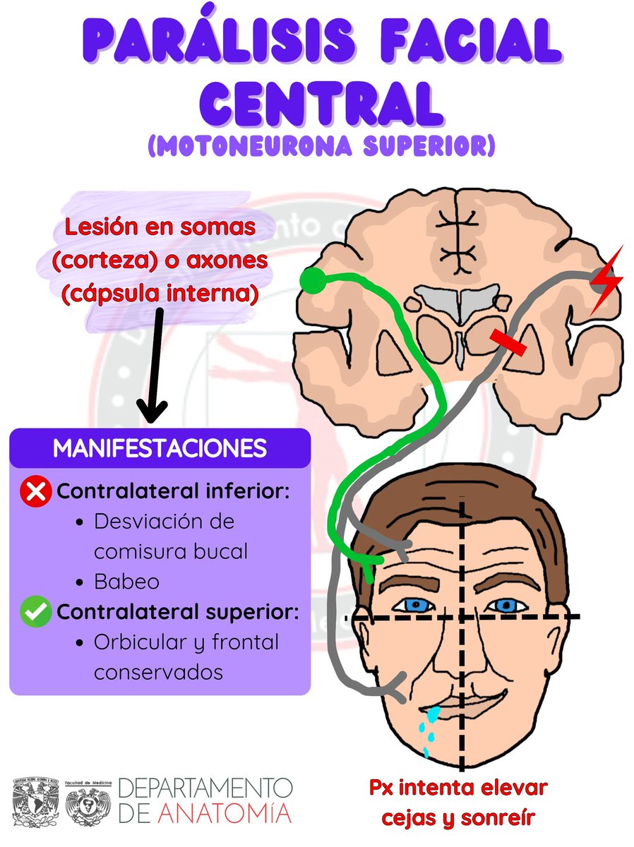 Parálisis facial central 🫨
#AnatomiaUnam #facmed #paralisisfacial