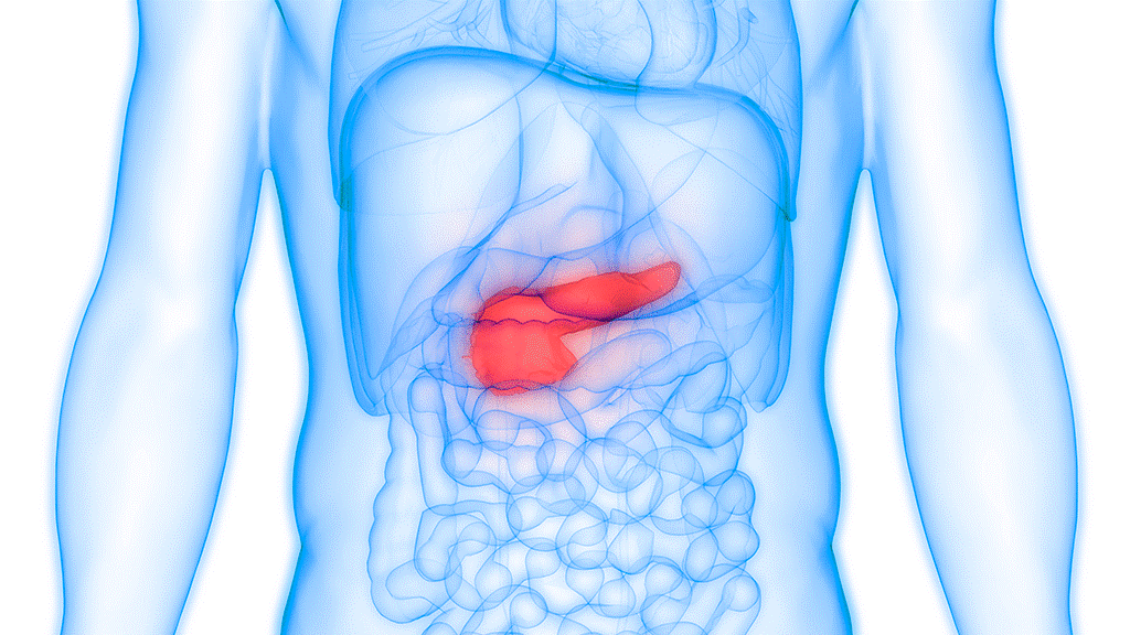 Gustave Roussy Research 🔬 (@g_r_research) on Twitter photo New data in pancreatic #cancer!
The NEOPAN Phase III trial led by Prof. Michel Ducreux (<a href="/GustaveRoussy/">Gustave Roussy</a>) shows FOLFIRINOX improves PFS vs gemcitabine in LAPC, with similar OS and QoL.
👉 doi.org/10.1200/JCO-24…
#PancreaticCancer #OncoResearch #FOLFIRINOX New data in pancreatic #cancer!
The NEOPAN Phase III trial led by Prof. Michel Ducreux (<a href="/GustaveRoussy/">Gustave Roussy</a>) shows FOLFIRINOX improves PFS vs gemcitabine in LAPC, with similar OS and QoL.
👉 doi.org/10.1200/JCO-24…
#PancreaticCancer #OncoResearch #FOLFIRINOX