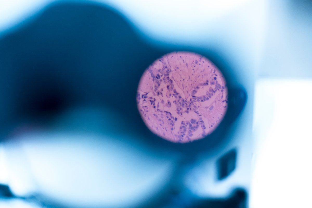 National Biofilms Innovation Centre (NBIC) (@ukbiofilms) on Twitter photo 📌<a href="/ucddublin/">University College Dublin</a> are seeking a temporary Post-doctoral Research Fellow in Level 1 or 2 in #Microbiology #Imaging
🔬This project aims to develop new mechanistic insight in the interaction between #biofilms and aggregates/particulates
Apply by 6 June 2025 tinyurl.com/5n7ner3d 📌<a href="/ucddublin/">University College Dublin</a> are seeking a temporary Post-doctoral Research Fellow in Level 1 or 2 in #Microbiology #Imaging
🔬This project aims to develop new mechanistic insight in the interaction between #biofilms and aggregates/particulates
Apply by 6 June 2025 tinyurl.com/5n7ner3d
