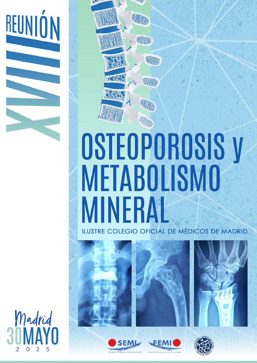 Sociedad Española de Medicina Interna (SEMI) (@sociedad_semi) on Twitter photo 📢Mañana tendrá lugar en #Madrid la XVIII Reunión de Osteoporosis y Metabolismo Mineral del Grupo de Trabajo de Osteoporosis y Metabolismo Mineral (<a href="/GtoSemi/">OSTEOPOROSIS_SEMI</a>) de <a href="/Sociedad_SEMI/">Sociedad Española de Medicina Interna (SEMI)</a> 🏥🩺
🗓️ 30 de mayo
📍 Sede del <a href="/Icomem_Oficial/">ICOMEM</a>
🔗 oymm-semi.com
#MedicinaInterna 📢Mañana tendrá lugar en #Madrid la XVIII Reunión de Osteoporosis y Metabolismo Mineral del Grupo de Trabajo de Osteoporosis y Metabolismo Mineral (<a href="/GtoSemi/">OSTEOPOROSIS_SEMI</a>) de <a href="/Sociedad_SEMI/">Sociedad Española de Medicina Interna (SEMI)</a> 🏥🩺
🗓️ 30 de mayo
📍 Sede del <a href="/Icomem_Oficial/">ICOMEM</a>
🔗 oymm-semi.com
#MedicinaInterna