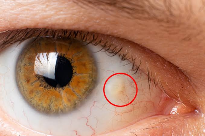 #MedX What is the diagnosis?