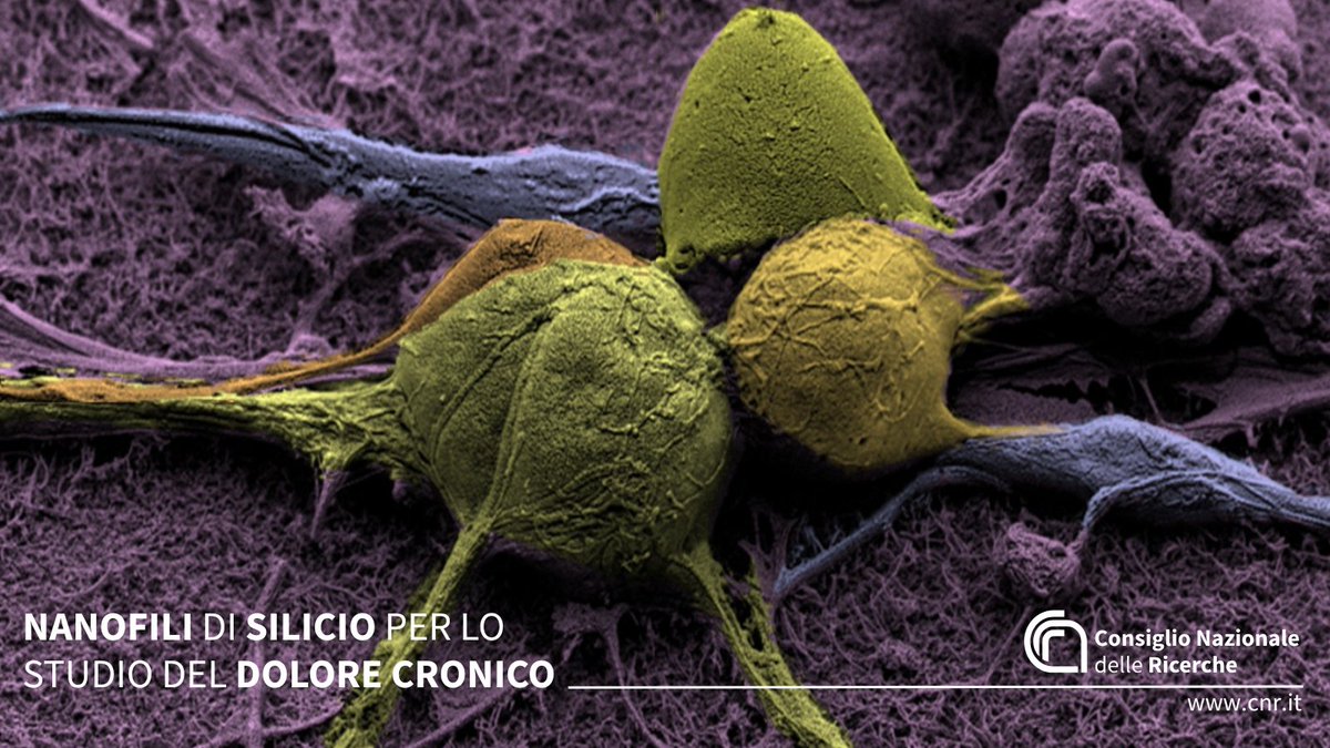 CNR Consiglio Nazionale delle Ricerche (@cnrsocial_) on Twitter photo Nanofili di silicio per lo studio del #dolorecronico
Da #Cnr_Imm e <a href="/Cnr_Isof/">CNR_ISOF</a>, in collaborazione con <a href="/Unibo/">Università di Bologna</a>, una nuova strategia per monitorare in vitro l’attività elettrica dei “neuroni del dolore”
Per saperne di più, vai su👇
cnr.it/it/news/13543
<a href="/AdvPortfolio/">Advanced Portfolio News</a> Nanofili di silicio per lo studio del #dolorecronico
Da #Cnr_Imm e <a href="/Cnr_Isof/">CNR_ISOF</a>, in collaborazione con <a href="/Unibo/">Università di Bologna</a>, una nuova strategia per monitorare in vitro l’attività elettrica dei “neuroni del dolore”
Per saperne di più, vai su👇
cnr.it/it/news/13543
<a href="/AdvPortfolio/">Advanced Portfolio News</a>