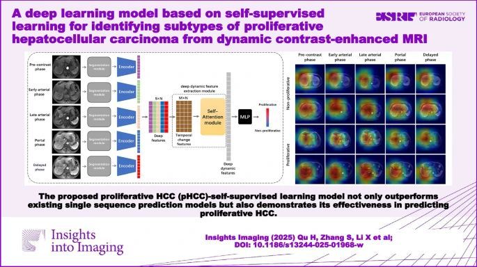 With the goal of improving diagnostic precision and guiding personalized treatment planning, Hui Qu et al employed dynamic contrast enhanced #MRI to noninvasily predict the proliferative subtype of hepatocellular carcinoma, developing a #DeepLearning prediction model