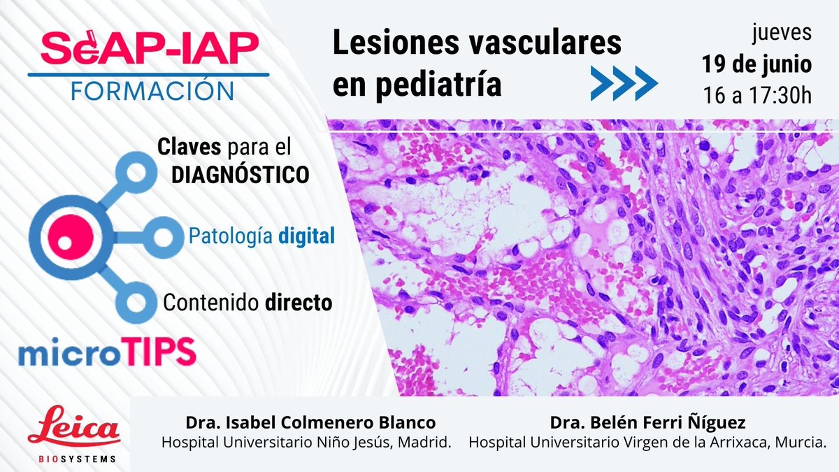 🔔 ¡Queda 1 semana!
#MicroTIPs vuelve con su formato favorito: directo, digital y esencial.
🩸👶 Lesiones vasculares en pediatría
🗓️ Miércoles 19 de junio, 16:00-17:30h (GMT+1)
👩‍⚕️ Dras. Isabel Colmenero y Belén Ferri
🔗 Patrocina <a href="/LeicaBio/">Leica Biosystems</a> 
¡Anótalo en tu agenda!