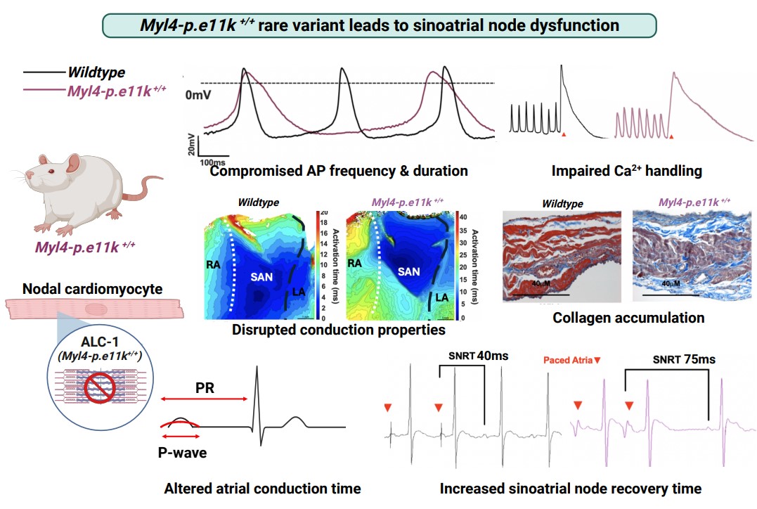CircEP (@circulationep) on Twitter photo Heart pacemaker failure (HPF) causes fainting and needs artificial pacing. We studied how heart disease causes HPF by affecting cardiac electricity <a href="/deanna_sos/">Deanna Sosnowski</a> <a href="/StanleyNattel/">Stanley Nattel</a> #AHAJournals #Epeeps
doi.org/10.1161/CIRCEP⦠Heart pacemaker failure (HPF) causes fainting and needs artificial pacing. We studied how heart disease causes HPF by affecting cardiac electricity <a href="/deanna_sos/">Deanna Sosnowski</a> <a href="/StanleyNattel/">Stanley Nattel</a> #AHAJournals #Epeeps
doi.org/10.1161/CIRCEPā¦