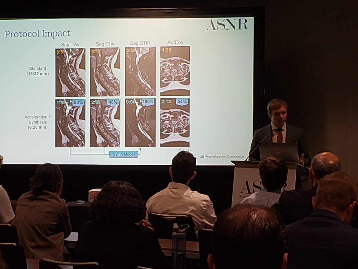 Campbell 🍅🥫 (@lofimri) on Twitter photo Last week, I attended <a href="/TheASNR/">The American Society of Neuroradiology</a>—hosted in my city, Philadelphia! 🌆🧠
I'm grateful to #ASNR25 for the opportunity to present our work at <a href="/SubtleMedical/">Subtle Medical, Inc.</a>:
1. Synthesizing DIR from T1 & T2-FLAIR
2. Automating brain alignment
3. Image synthesis & enhancement to accelerate protocols Last week, I attended <a href="/TheASNR/">The American Society of Neuroradiology</a>—hosted in my city, Philadelphia! 🌆🧠
I'm grateful to #ASNR25 for the opportunity to present our work at <a href="/SubtleMedical/">Subtle Medical, Inc.</a>:
1. Synthesizing DIR from T1 & T2-FLAIR
2. Automating brain alignment
3. Image synthesis & enhancement to accelerate protocols