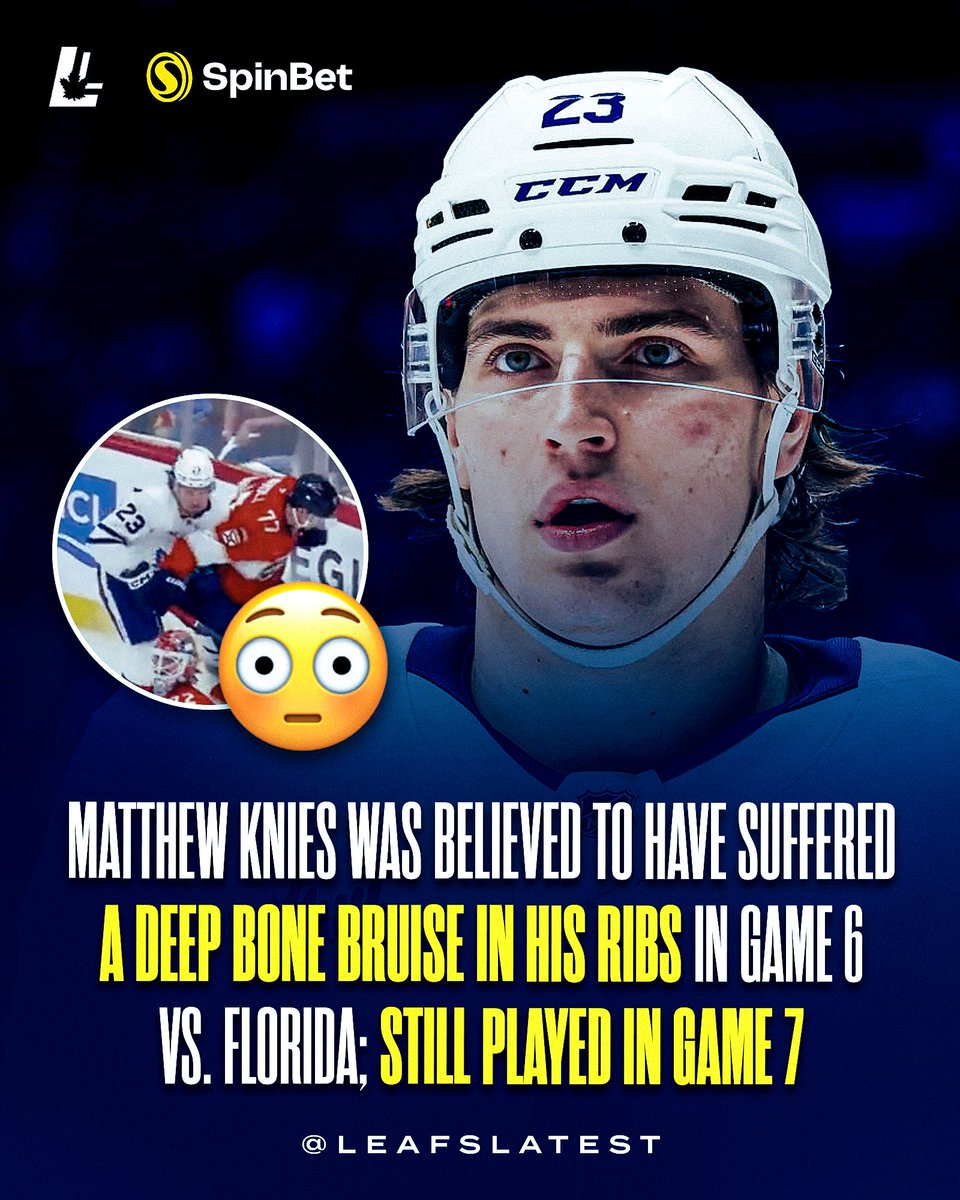 Leafslatest (@leafslatest) on Twitter photo π¨ PLAYOFF WARRIOR: Itβs believed that Matthew Knies sustained a deep bone bruise to his ribs during Game 6 against the Florida Panthers.
Despite being in considerable pain, he quickly made the decision not to miss Game 7. ππͺ
β <a href="/joshuakloke/">Joshua Kloke</a>
#LeafsForever π¨ PLAYOFF WARRIOR: Itβs believed that Matthew Knies sustained a deep bone bruise to his ribs during Game 6 against the Florida Panthers.
Despite being in considerable pain, he quickly made the decision not to miss Game 7. ππͺ
β <a href="/joshuakloke/">Joshua Kloke</a>
#LeafsForever