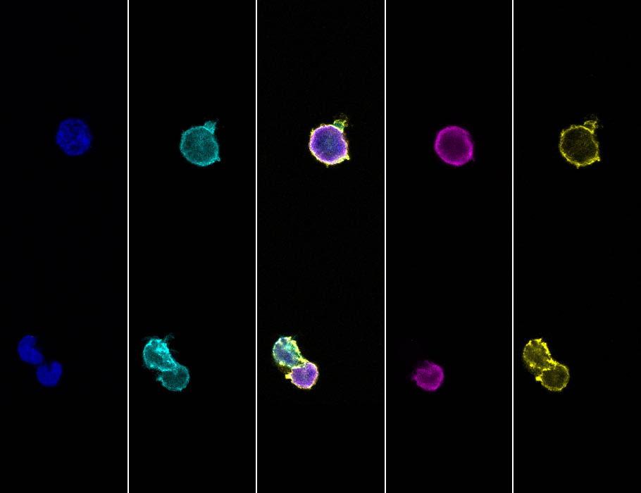 SciImmunology's tweet photo. Scientists have engineered a viral protein that can harness LCK kinase to activate #STAT5 and sustain cytotoxic T cell activity within tumors in mice. @UMPharmacology
Read more in Science #Immunology: https://t.co/x0YMELyr56 https://t.co/pSq5hzIovw