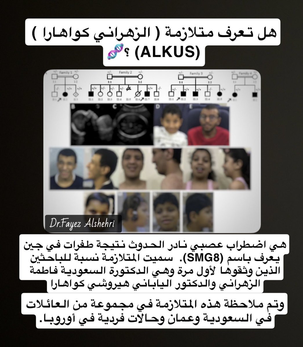 Dr_Fayez_sh's tweet photo. ماذا تعرف عن متلازمة الزهراني كواهارا (ALKUS) ؟..  وكيف تحدث ؟  اترككم مع الصور التالية 🧬🧬

#متلازمة #الزهراني #syndrome #معلومات #علم_الوراثة #genes #genetics #chromosomes #الكروموسومات #العلوم #biotech #كواهار https://t.co/VppN7VJxG0