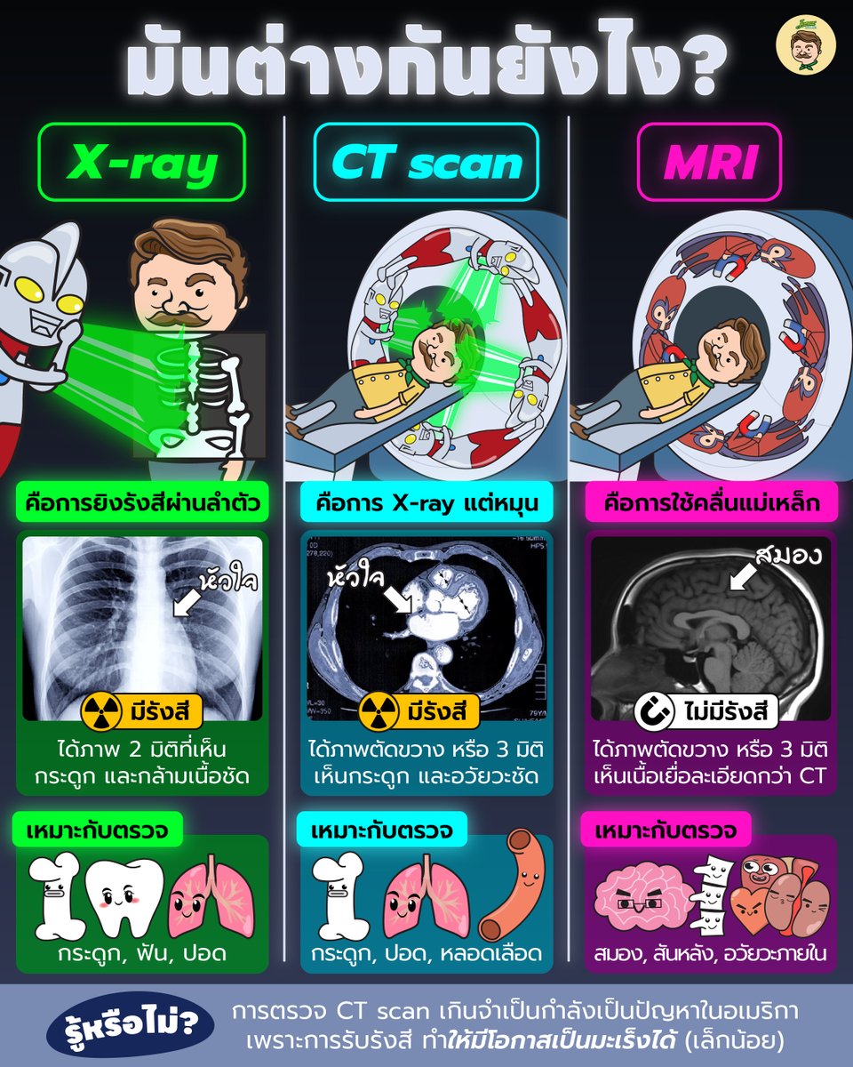 jones_salad's tweet image. เอ็กซ์เรย์แต่ละแบบพวกนี้ ต่างกันยังไง?

เวลาไปโรงพยาบาล คงเคยได้ยินคำว่าเอ็กซ์เรย์ (X-ray) อยู่แล้ว ก็คือการยิงรังสีเพื่อตรวจอวัยวะภายในของเราอ่ะครับ

แต่การตรวจด้วยชื่อแปลก ๆ  เช่น CT-Scan,  MRI เราไม่รู้ว่าเขาทำแบบไหน? แล้วแต่ละแบบมันต่างกันยังไง? ลุงไปหาข้อมูลมาให้แล้วครับ